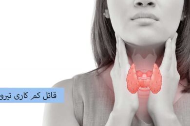 قاتل کم کاری تیروئید