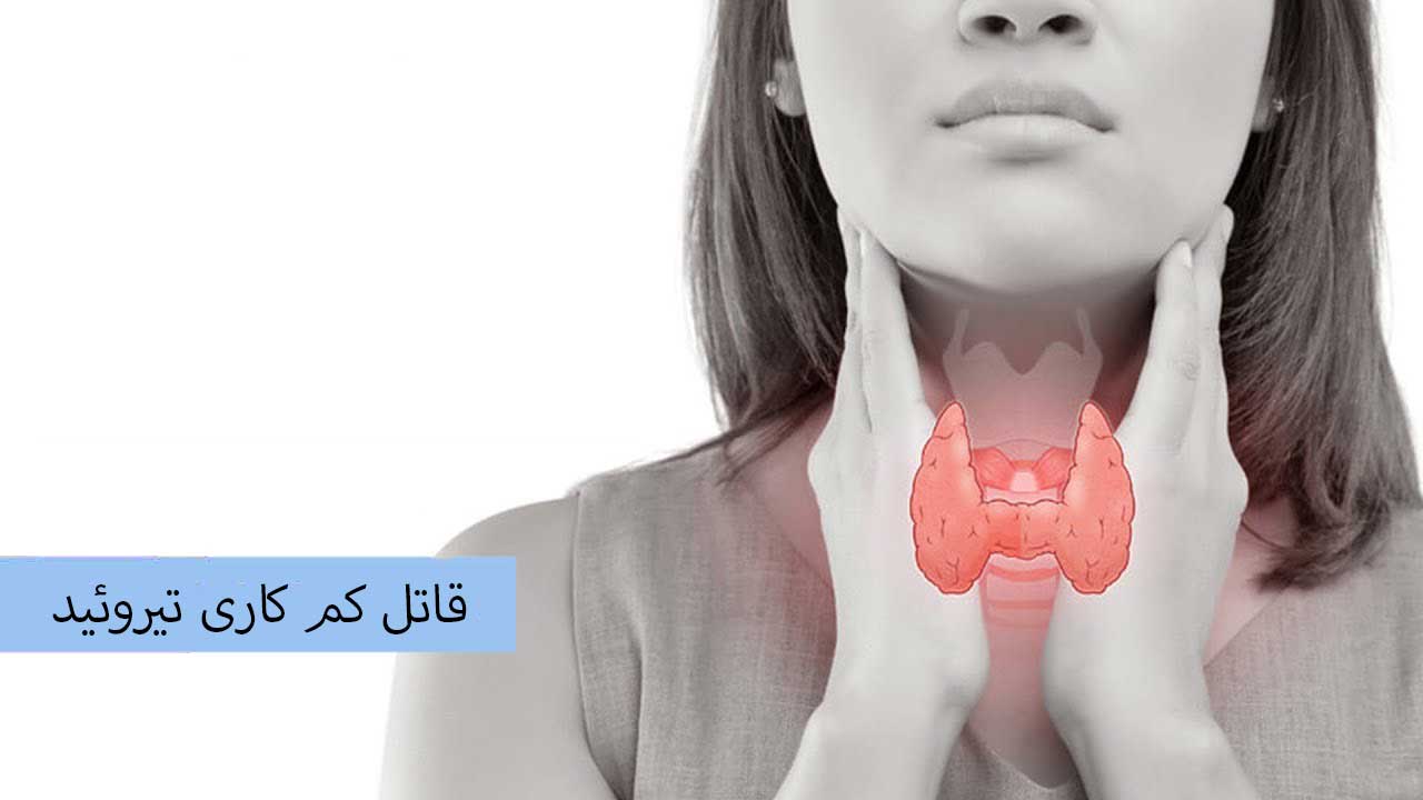 قاتل کم کاری تیروئید