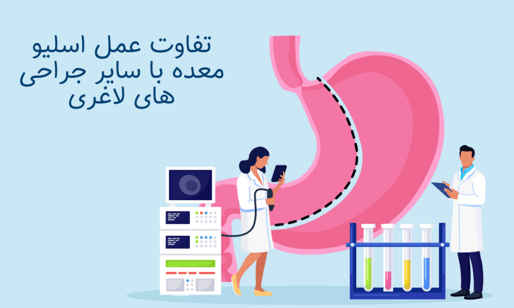 تفاوت عمل اسلیو معده با سایر جراحی های لاغری