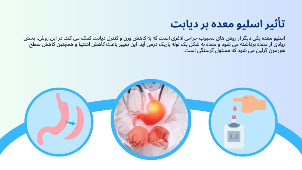 تأثیر اسلیو معده بر دیابت